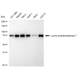 61526-WB-1-300x300-1.webp KD-Validated KAT7 Rabbit mAb (20 μl)