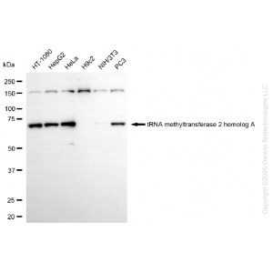 KD-Validated TRMT2A Rabbit mAb (20 μl)