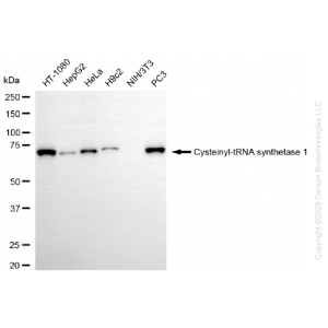 KD-Validated CARS1 Rabbit mAb (20 μl)