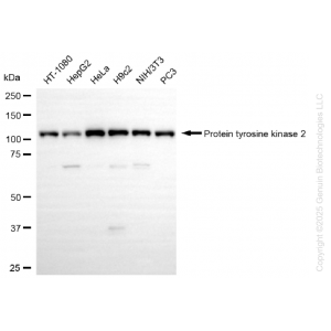 KD-Validated PTK2 Rabbit mAb (20 μl)