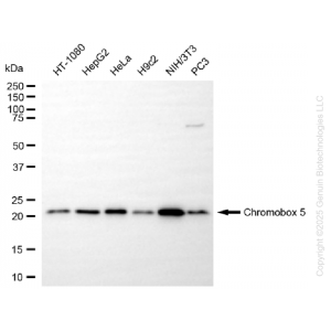KD-Validated CBX5 Rabbit mAb (20 μl)