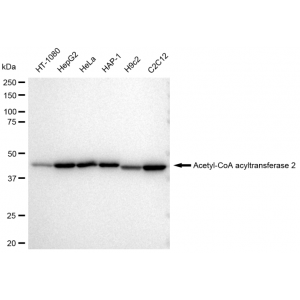 KD-Validated ACAA2 Rabbit mAb (20 μl)