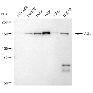 KD-Validated AGL Rabbit mAb (20 μl)