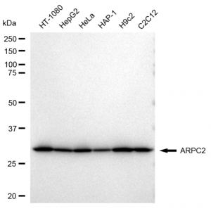 KD-Validated ARPC2 Rabbit mAb (20 μl)