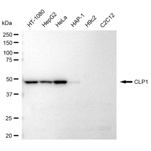 KD-Validated CLP1 Rabbit mAb (20 μl)