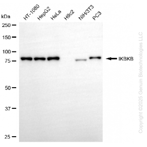 KD-Validated IKBKB Rabbit mAb (20 μl)