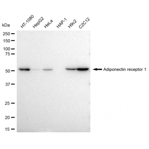 KD-Validated ADIPOR1 Rabbit mAb (20 μl)
