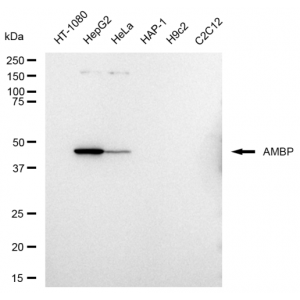 KD-Validated AMBP Rabbit mAb (20 μl)