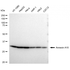KD-Validated ANXA10 Rabbit mAb (20 μl)