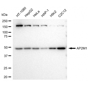 KD-Validated AP2M1 Rabbit mAb (20 μl)