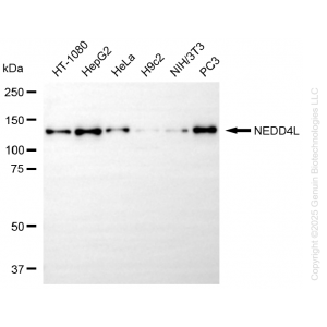 KD-Validated NEDD4L Rabbit mAb (20 μl)