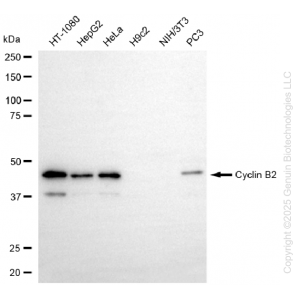 KD-Validated CCNB2 Rabbit mAb (20 μl)