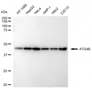 KD-Validated ATG4B Rabbit mAb (20 μl)