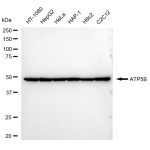 KD-Validated ATP5B Rabbit mAb (20 μl)