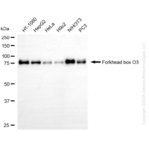 KD-Validated FOXO3 Rabbit mAb (20 μl)