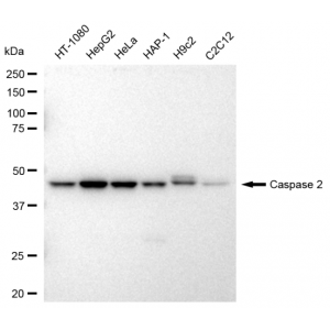 KD-Validated CASP2 Rabbit mAb (20 μl)