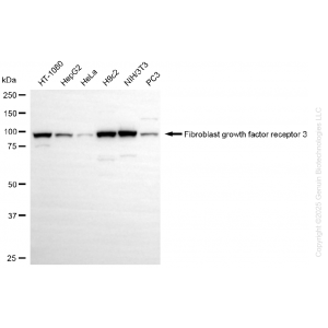 KD-Validated FGFR3 Rabbit mAb (20 μl)