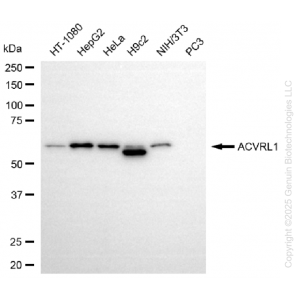 KD-Validated ACVRL1 Rabbit mAb (20 μl)