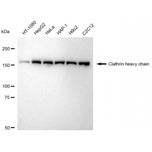KD-Validated CLTC Rabbit mAb (20 μl)
