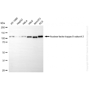 KD-Validated NFKB2 Rabbit mAb (20 μl)