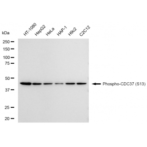 KD-Validated Phospho-CDC37 (S13) Rabbit mAb (20 μl)