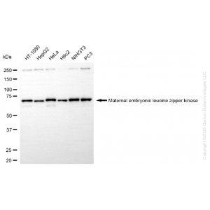 KD-Validated MELK Rabbit mAb (20 μl)