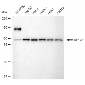 KD-Validated AP1G1 Rabbit mAb (20 μl)