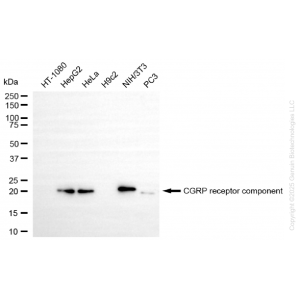KD-Validated CRCP Rabbit mAb (20 μl)