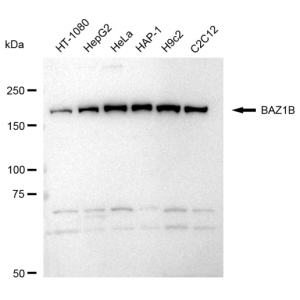KD-Validated BAZ1B Rabbit mAb (20 μl)