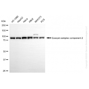 KD-Validated EXOC2 Rabbit mAb (20 μl)