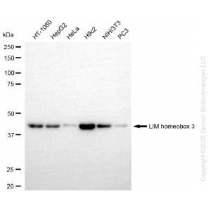 KD-Validated LHX3 Rabbit mAb (20 μl)