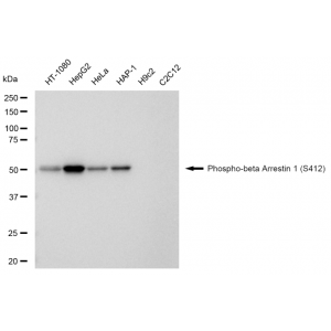 KD-Validated Phospho-ARRB1 (S412) Rabbit mAb (20 μl)