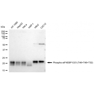 KD-Validated Phospho-eIF4EBP1/2/3 (T46+T46+T32) Rabbit mAb (20 μl)