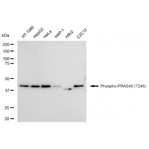 KD-Validated Phospho-PRAS40 (T246) Rabbit mAb (20 μl)
