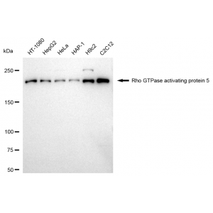 KD-Validated ARHGAP5 Rabbit mAb (20 μl)