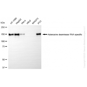 KD-Validated ADAR Rabbit mAb (20 μl)