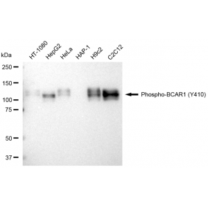 KD-Validated Phospho-BCAR1 (Y410) Rabbit mAb (20 μl)