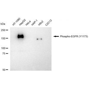 KD-Validated Phospho-EGFR (Y1173) Rabbit mAb (20 μl)