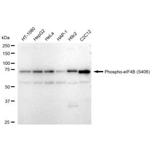 KD-Validated Phospho-eIF4B (S406) Rabbit mAb (20 μl)