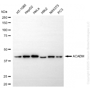 KD-Validated ACADM Rabbit mAb (20 μl)
