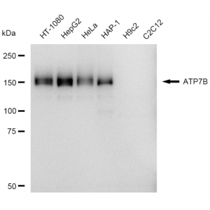 KD-Validated ATP7B Rabbit mAb (20 μl)
