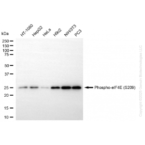 KD-Validated Phospho-eIF4E (S209) Rabbit mAb (20 μl)