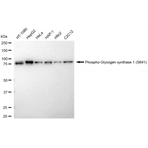 KD-Validated Phospho-GYS1 (S641) Rabbit mAb (20 μl)