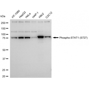 KD-Validated Phospho-STAT1 (S727) Rabbit mAb (20 μl)