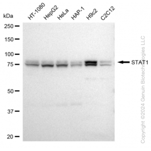 KD-Validated STAT1 Rabbit mAb (20 μl)
