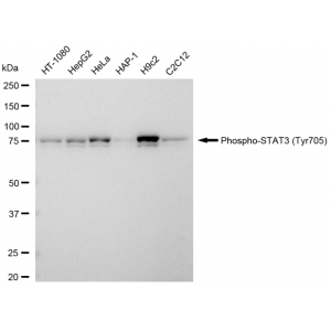 KD-Validated Phospho-STAT3 (Tyr705) Rabbit mAb (20 μl)