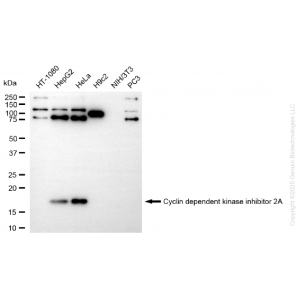 KD-Validated CDKN2A Rabbit mAb (20 μl)