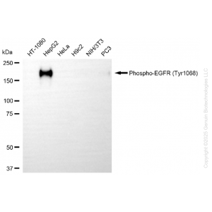 KD-Validated Phospho-EGFR (Tyr1068) Rabbit mAb (20 μl)