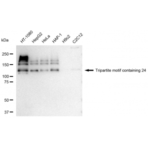 KD-Validated TRIM24 Rabbit mAb (20 μl)