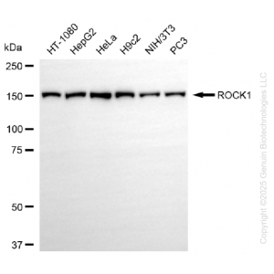 KD-Validated ROCK1 Rabbit mAb (20 μl)